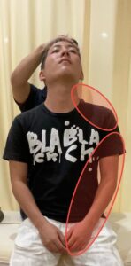 ジャクソンテスト