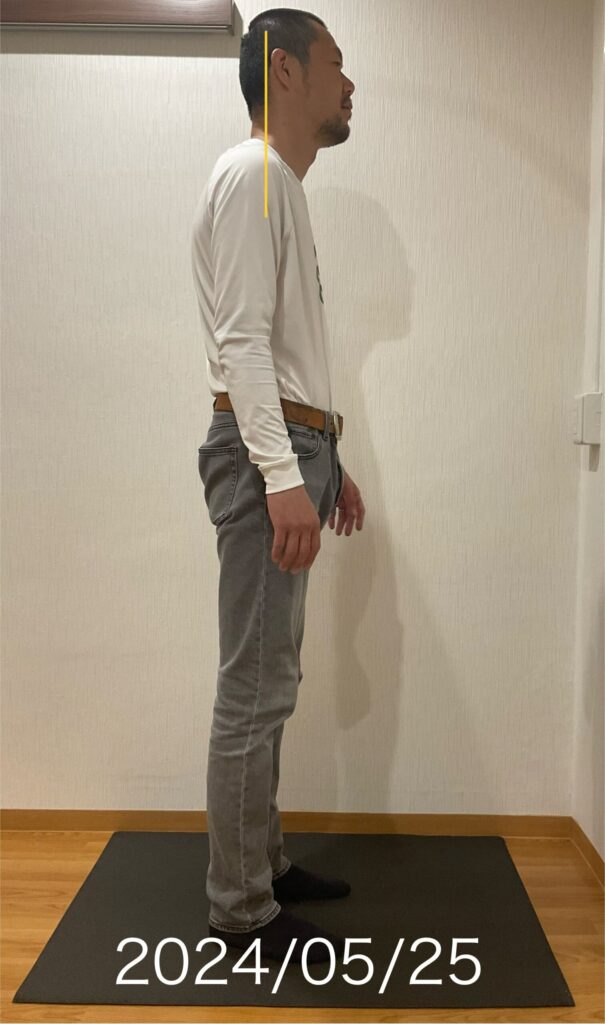 頭部前方位の男性2024年9月19日