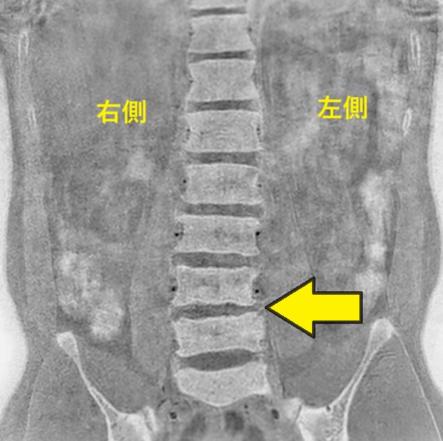 水津さんのMRI画像　正面