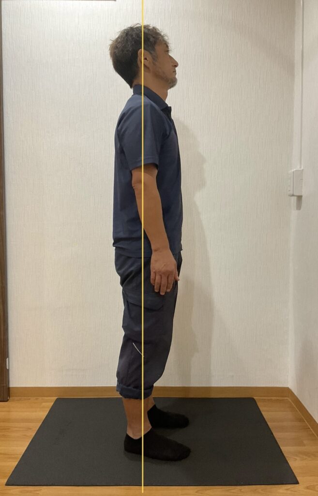 水津さんの姿勢　アフター