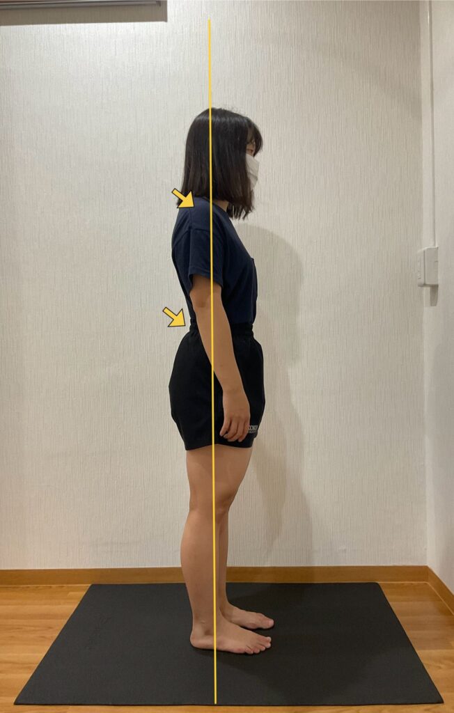 反り腰の姿勢 アフター