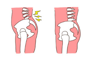 反り腰のイラスト